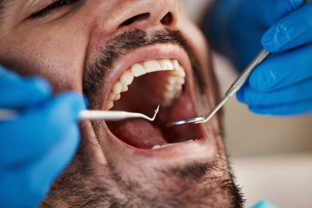 Best Emergency Dentist for Knocked-Out Tooth in Marlette, MI